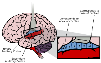 Auditory cortex