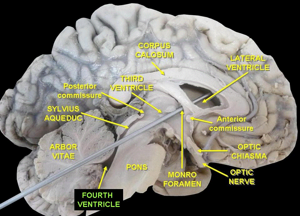 Fourth ventricle