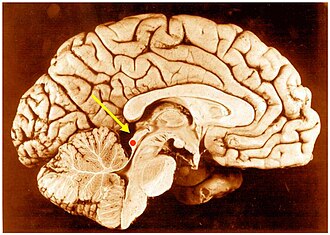 Inferior colliculus