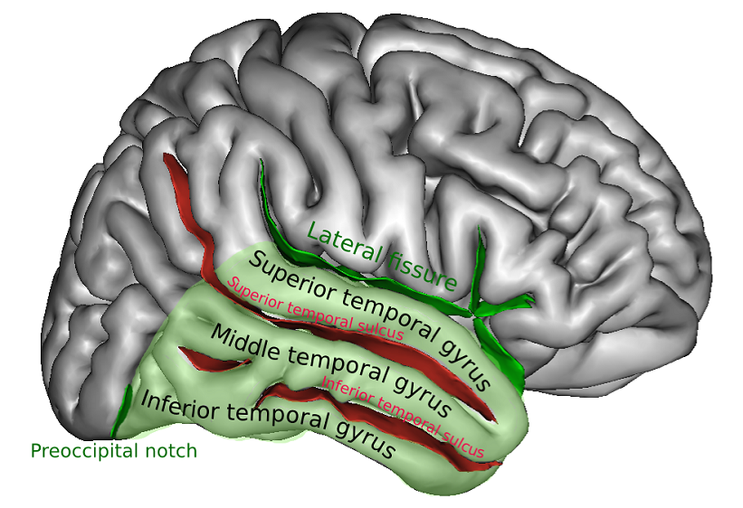 Middle temporal gyrus