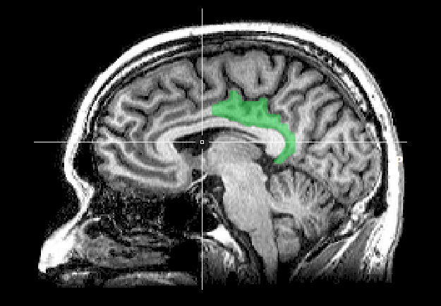 Posterior cingulate cortex