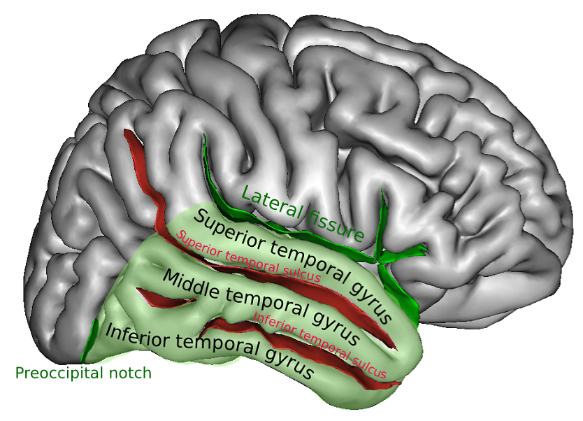 Superior temporal gyrus