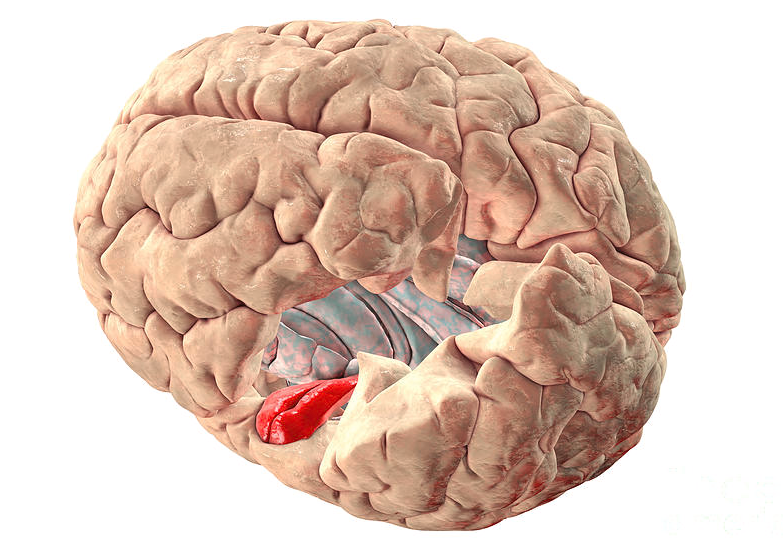 Transverse temporal gyrus