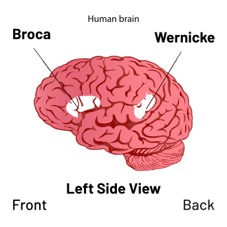 Wernicke's area